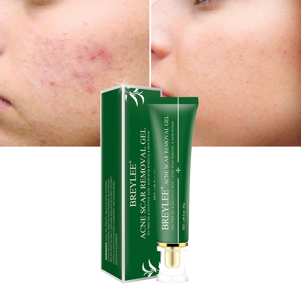 Acne Scar Removal Gel Tea Tree
