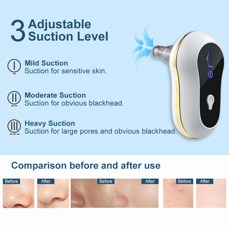 Suction Blackhead Remover Kit Electric