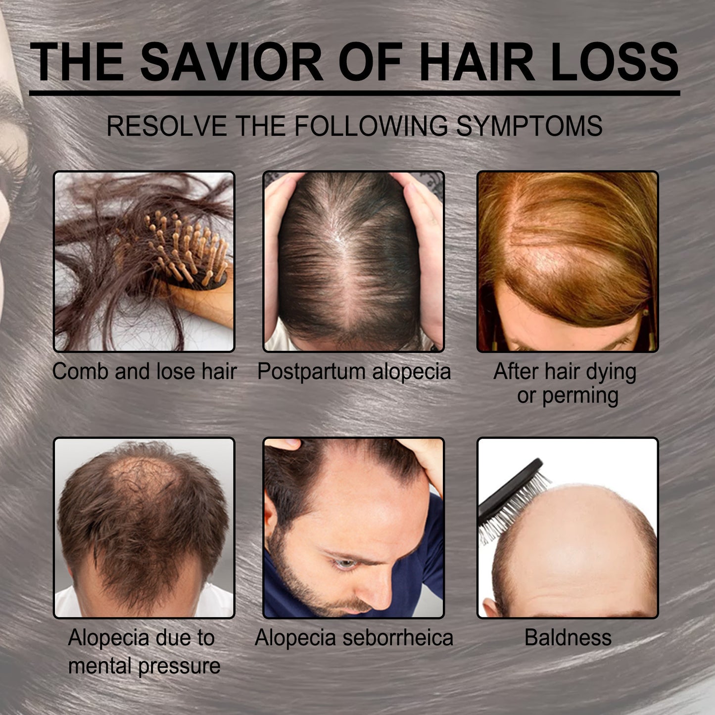 Rosemary Hair Care Essential Oil Anti-loss