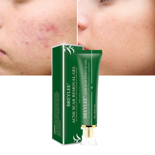 Acne Scar Removal Gel Tea Tree