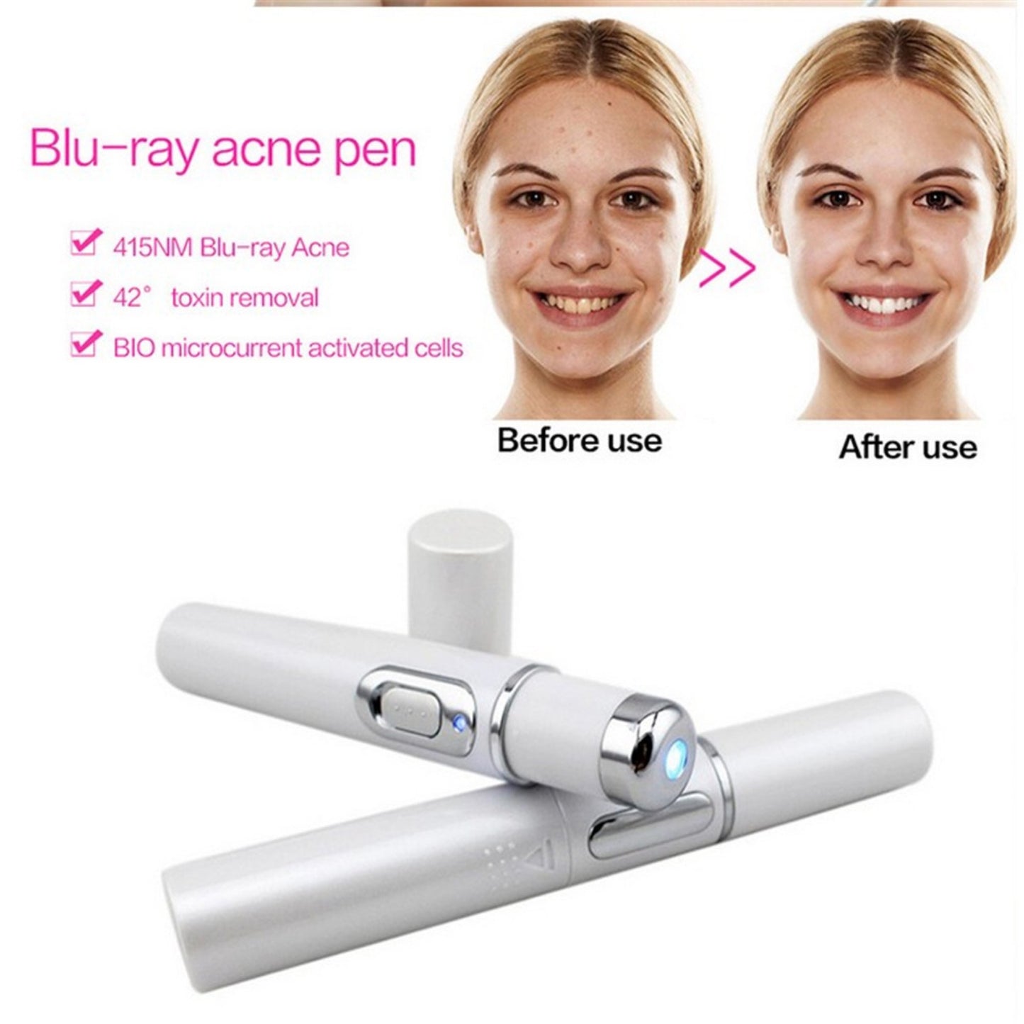 Blue Light Acne & Wrinkle Removal
