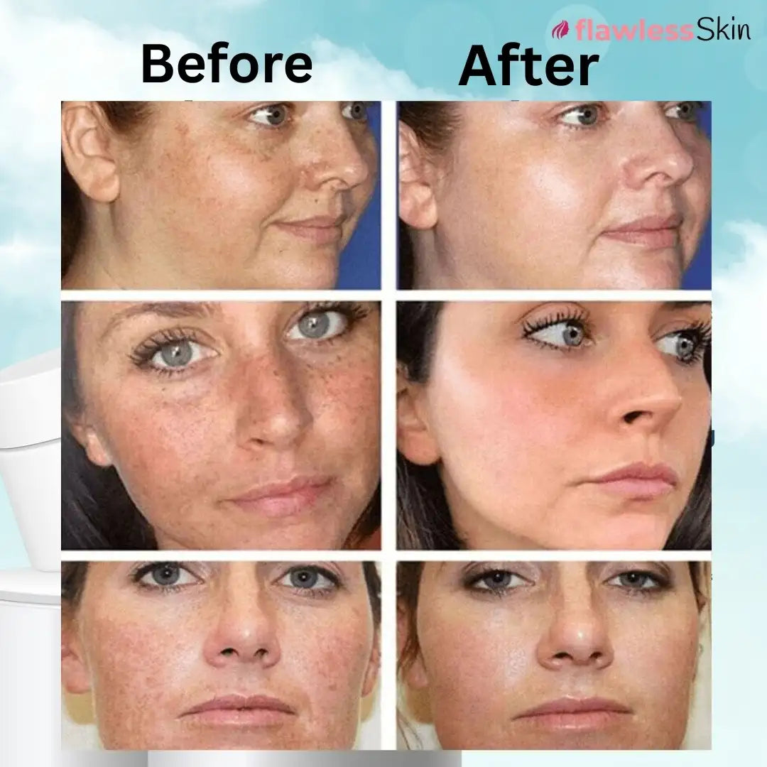 Whitening Dark Spot and Melasma Cream For Men And Women Available Body Care