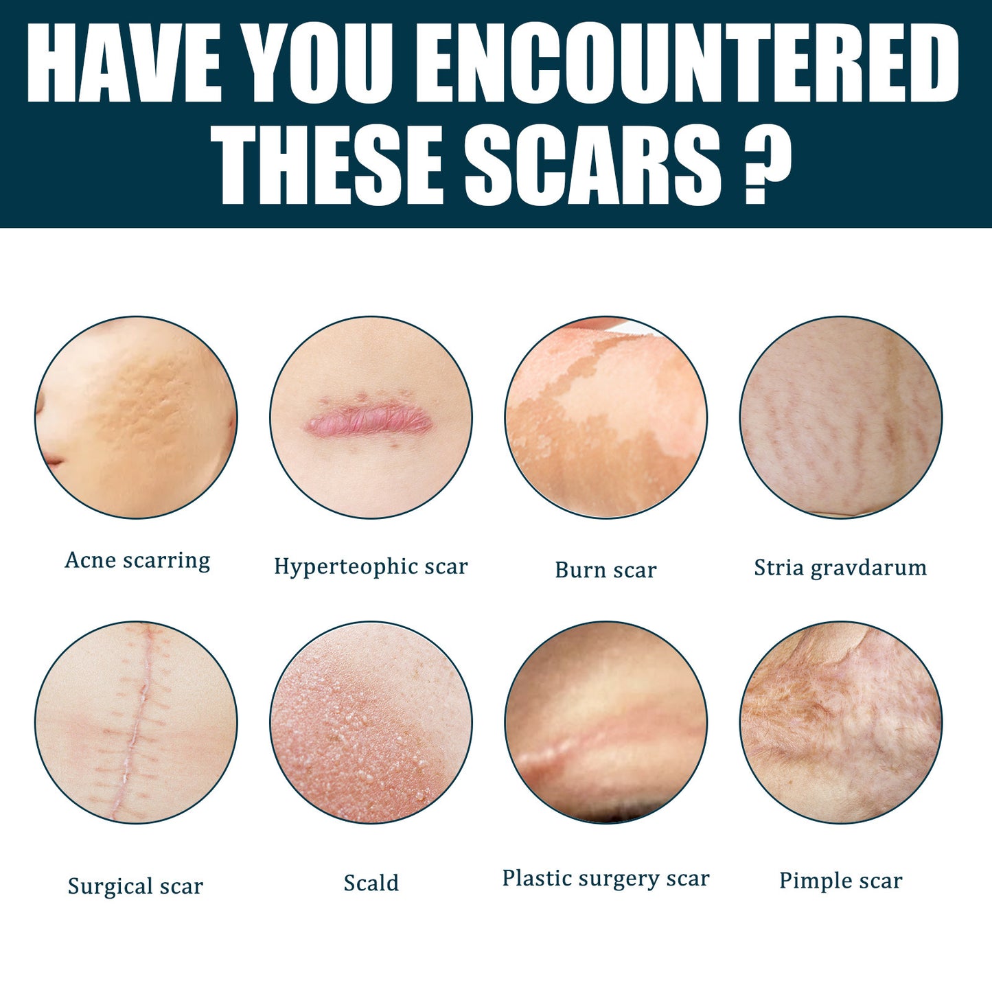 Fade Scar Gel Skin Burning Care Repair Marks
