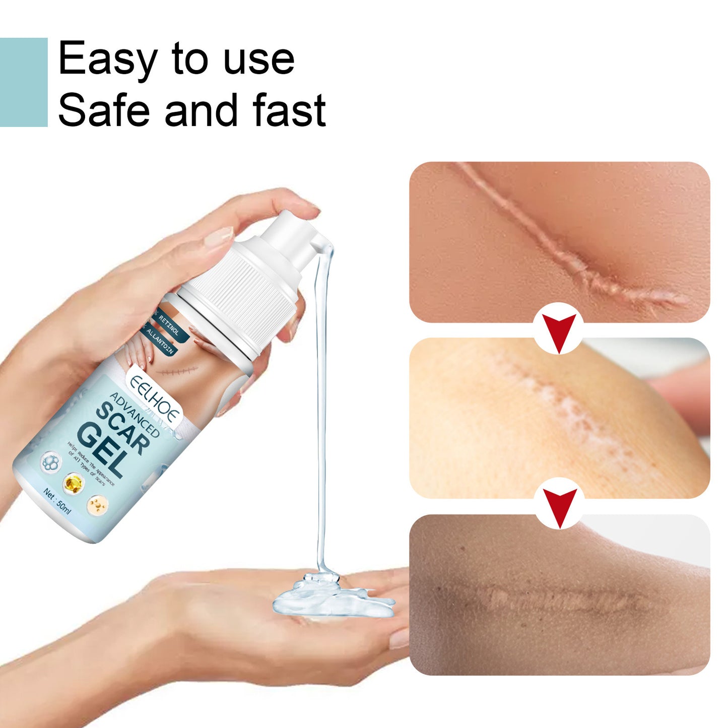 Fade Scar Gel Skin Burning Care Repair Marks